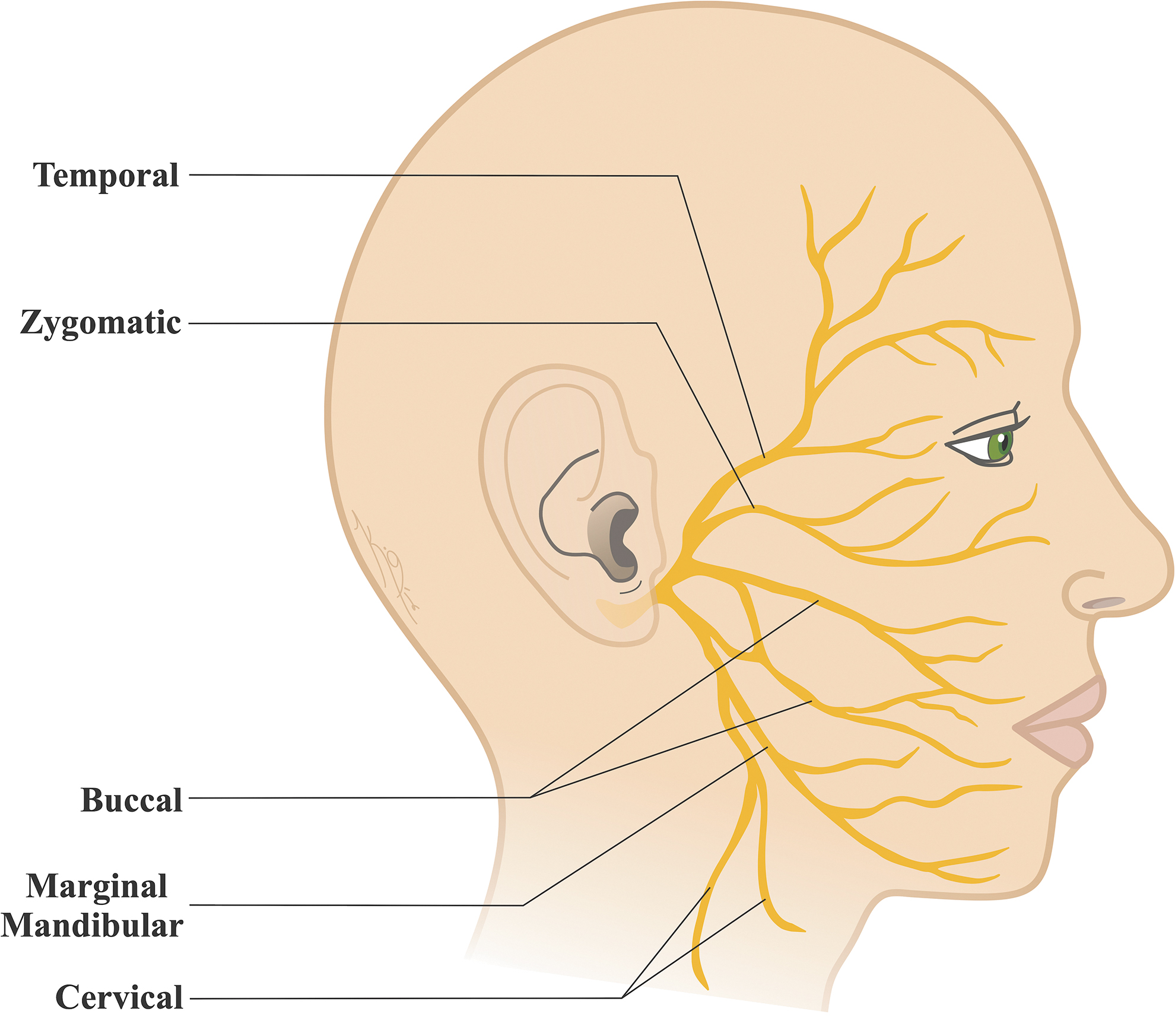 Causes of Facial Paralysis